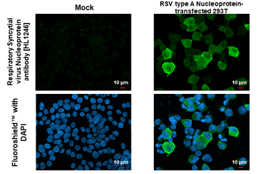 Anti-Respiratory Syncytial virus Nucleoprotein antibody [HL1246] used in Immunocytochemistry/ Immunofluorescence (ICC/IF). GTX636648