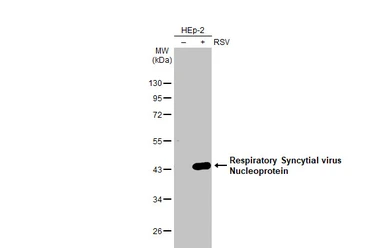 Anti-Respiratory Syncytial virus Nucleoprotein antibody [HL1248] used in Western Blot (WB). GTX636650
