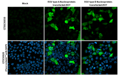 Anti-Respiratory Syncytial virus Nucleoprotein antibody [HL1248] used in Immunocytochemistry/ Immunofluorescence (ICC/IF). GTX636650
