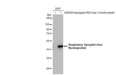 Anti-Respiratory Syncytial virus Nucleoprotein antibody [HL1296] used in Western Blot (WB). GTX636710