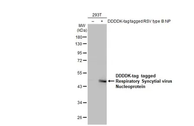 Anti-Respiratory Syncytial virus Nucleoprotein antibody [HL1296] used in Western Blot (WB). GTX636710