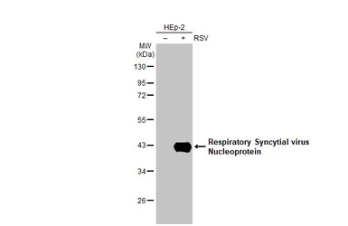 Anti-Respiratory Syncytial virus Nucleoprotein antibody [HL1296] used in Western Blot (WB). GTX636710
