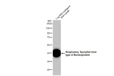 Anti-Respiratory Syncytial virus type A Nucleoprotein antibody [HL1297] used in Western Blot (WB). GTX636711