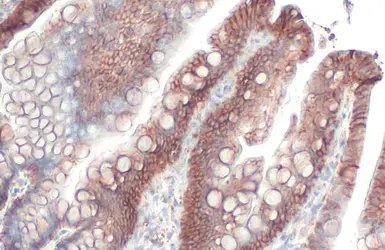 Anti-EpCAM antibody [HL1339] used in IHC (Paraffin sections) (IHC-P). GTX636759