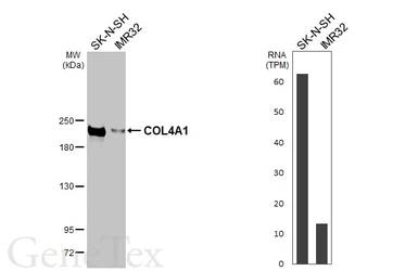 Anti-COL4A1 antibody [HL1351] used in Western Blot (WB). GTX636771