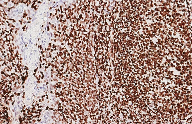 Anti-PARP antibody [HL1364] used in IHC (Paraffin sections) (IHC-P). GTX636804