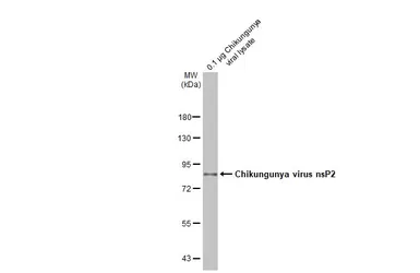 Anti-Chikungunya virus nsP2 antibody [HL1431] used in Western Blot (WB). GTX636897