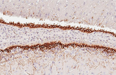 Anti-Vimentin antibody [HL1506] used in IHC (Paraffin sections) (IHC-P). GTX636980