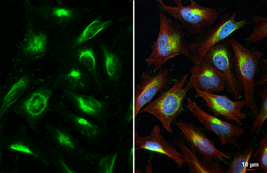 Anti-Vimentin antibody [HL1506] used in Immunocytochemistry/ Immunofluorescence (ICC/IF). GTX636980
