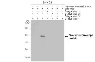 Anti-Zika virus Envelope protein antibody [HL1699] used in Western Blot (WB). GTX637298