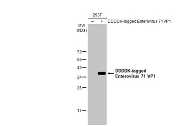 Anti-Enterovirus 71 VP1 antibody [HL1928] used in Western Blot (WB). GTX637687