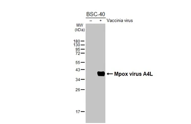 Anti-Mpox virus A4L antibody [HL2555] used in Western Blot (WB). GTX638927