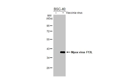 Anti-Mpox virus F13L antibody [HL2637] used in Western Blot (WB). GTX639093