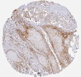 Anti-PD-L1 antibody [H302] HistoMAX&trade; used in IHC (Paraffin sections) (IHC-P). GTX639925
