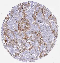 Anti-PD-L1 antibody [H302] HistoMAX&trade; used in IHC (Paraffin sections) (IHC-P). GTX639925
