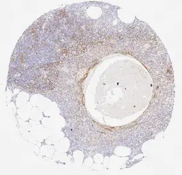 Anti-PD-L1 antibody [H302] HistoMAX&trade; used in IHC (Paraffin sections) (IHC-P). GTX639925