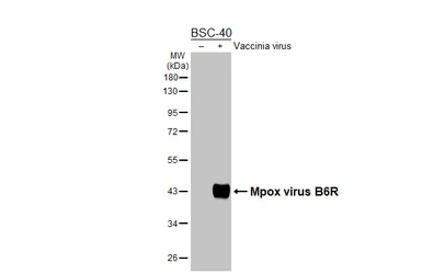 Anti-Mpox virus B6R antibody [HL3102] used in Western Blot (WB). GTX640548