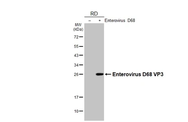 Anti-Enterovirus D68 VP3 antibody [HL3202] used in Western Blot (WB). GTX640842