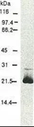 Anti-Hepatitis C virus Core Antigen antibody [H6-29] used in Western Blot (WB). GTX64113