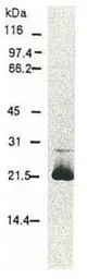 Anti-Hepatitis C virus Core Antigen antibody [H6-29] (Biotin) used in Western Blot (WB). GTX64114