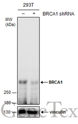 Anti-BRCA1 antibody [17F8] - ChIP grade used in Western Blot (WB). GTX70111