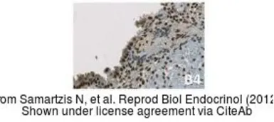 Anti-Estrogen Receptor beta antibody [14C8] used in IHC (Paraffin sections) (IHC-P). GTX70174