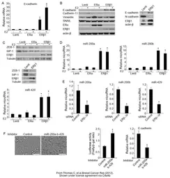 Anti-Estrogen Receptor beta antibody [14C8] used in Western Blot (WB). GTX70174