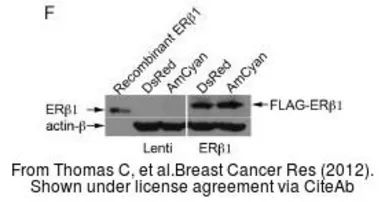 Anti-Estrogen Receptor beta antibody [14C8] used in Western Blot (WB). GTX70174
