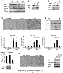 Anti-Estrogen Receptor beta antibody [14C8] used in Western Blot (WB). GTX70174