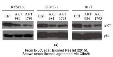 Anti-Nuclear Matrix Protein p84 antibody [5E10] used in Western Blot (WB). GTX70220