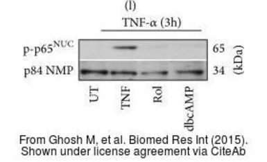 Anti-Nuclear Matrix Protein p84 antibody [5E10] used in Western Blot (WB). GTX70220