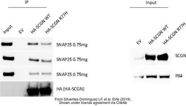 Anti-Nuclear Matrix Protein p84 antibody [5E10] used in Western Blot (WB). GTX70220