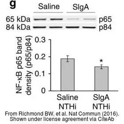 Anti-Nuclear Matrix Protein p84 antibody [5E10] used in Western Blot (WB). GTX70220