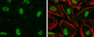 Anti-Nuclear Matrix Protein p84 antibody [5E10] used in Immunocytochemistry/ Immunofluorescence (ICC/IF). GTX70220