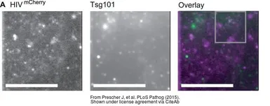 Anti-TSG101 antibody [4A10] used in Immunocytochemistry/ Immunofluorescence (ICC/IF). GTX70255