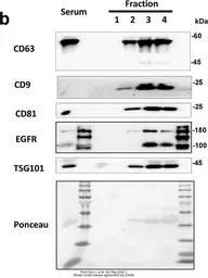 Anti-TSG101 antibody [4A10] used in Western Blot (WB). GTX70255