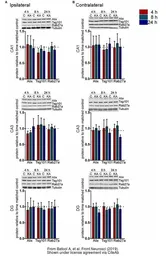 Anti-TSG101 antibody [4A10] used in Western Blot (WB). GTX70255