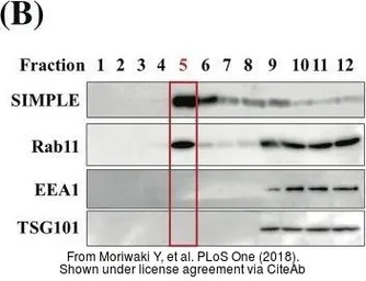 Anti-TSG101 antibody [4A10] used in Western Blot (WB). GTX70255