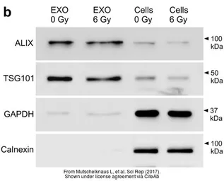 Anti-TSG101 antibody [4A10] used in Western Blot (WB). GTX70255