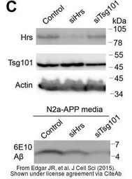 Anti-TSG101 antibody [4A10] used in Western Blot (WB). GTX70255