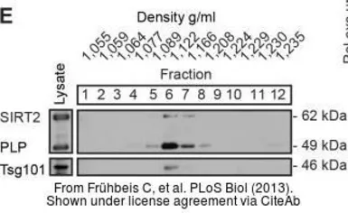 Anti-TSG101 antibody [4A10] used in Western Blot (WB). GTX70255