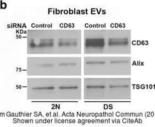 Anti-TSG101 antibody [4A10] used in Western Blot (WB). GTX70255