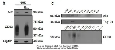Anti-TSG101 antibody [4A10] used in Western Blot (WB). GTX70255