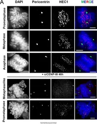 Anti-Hec1 antibody [9G3.23] used in Immunocytochemistry/ Immunofluorescence (ICC/IF). GTX70268