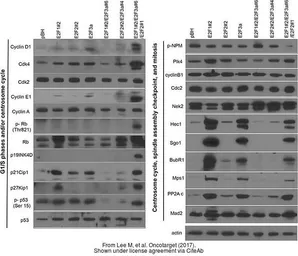 Anti-Hec1 antibody [9G3.23] used in Western Blot (WB). GTX70268