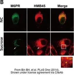 Anti-Melanoma associated antigen antibody [HMB45] used in Immunocytochemistry/ Immunofluorescence (ICC/IF). GTX71957