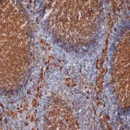 Anti-CD9 antibody [MM2/57] used in IHC (Frozen sections) (IHC-Fr). GTX76184