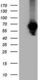 Anti-Alpha fetoprotein / AFP antibody [2A9] used in Western Blot (WB). GTX84954