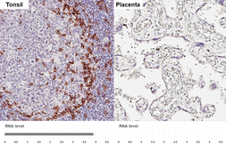 Anti-PD1 antibody [HL4386] used in IHC (Paraffin sections) (IHC-P). GTX643643
