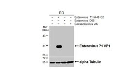 Anti-Enterovirus 71 VP1 antibody [HL4796] used in Western Blot (WB). GTX644808